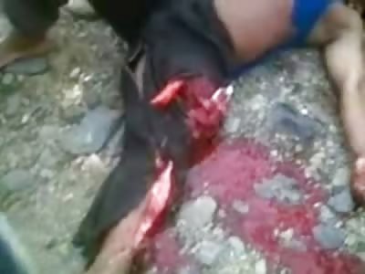 Mans Leg Snapped in Half and His Daughter in Catholic School Outfit