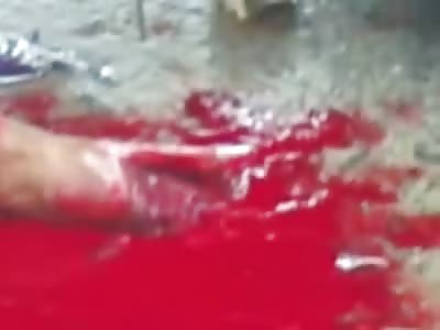 Stay Clam in Extreme Situations..Man with Severed Leg is Handed a Cell Phone to Call his Family