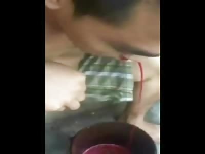 Nose Bleed to Death? What in the HELL are you Waiting For?