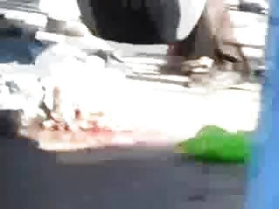 Man has Bus Lifted off of his Head....Ugh