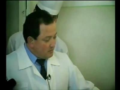 Man with Backward Knees