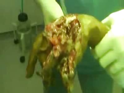 Completely FUBAR'd Hand