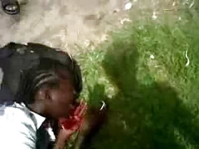 Boy with his Peeled Face just Wants a Taxi