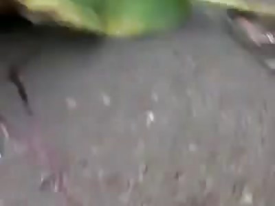 Mans Right Arm is Ripped Completely Off from Motorcycle Accident..In Total Shock