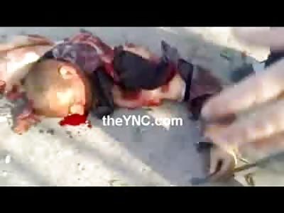 Man blown in Half is Comforted by anther Guy