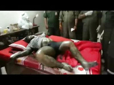 Follow the Fluid....The Oozing Woman is Looked Over by the Pointing Team 