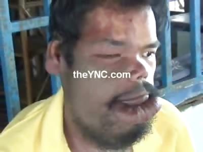 Poor Kid with Big Mouth Disease pleads for Help along with his Family