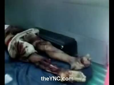 Bodies Piled up in the back of a Pickup Truck looks Disgusting