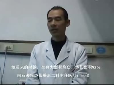 SAD: 14 Year Old Girl is Horribly Burned after Running into a Burning House to Try and Rescue People