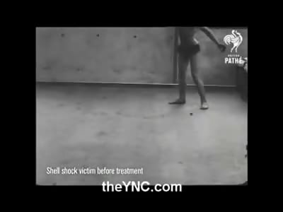 Bizarre Video of a World War 1 Shell Shock Survivor before and After Therapy