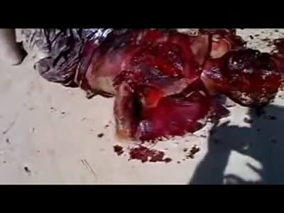 Pinhead Terrorist forgot to Plant the IED before he Detonated It, No Hands now