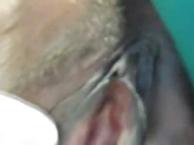 Absolutely Disgusting Video of a Woman's Vagina removed from Her Body (Warning it's Gross)