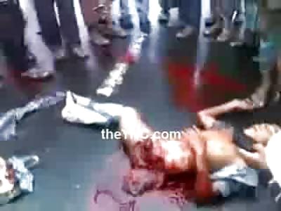 Boy with Ripped Off Limb Moans in Shock and Horror as Onlookers cant do anything to Help 