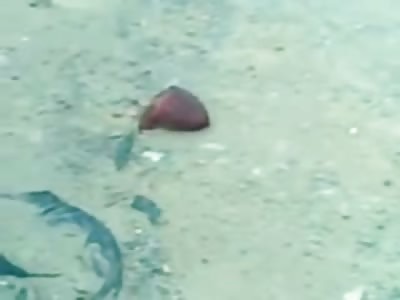 Helmet Saved his Head...However, his Guts and Heart Weren't So Luck