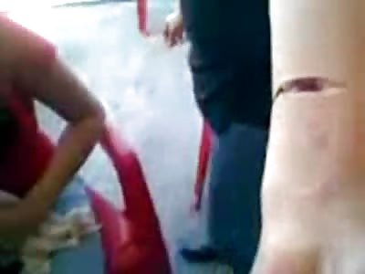 Very Cute Girl with Issues Slices her Arm Wide Open in front of Classmates During Lunch