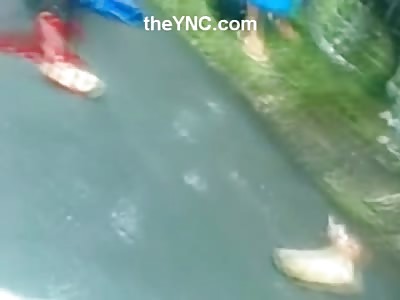 Gruesome Video of Man with Severed Foot Squirming in Terror on the Street