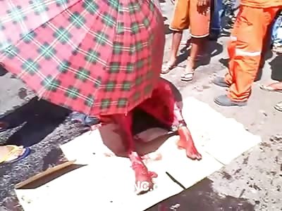 HORRIFYING: Skin Completely Shredded off mans Legs Following Motorcycle Accident