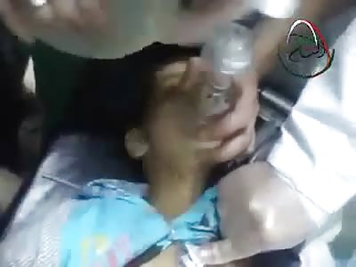 Poor Kid Sliced Open at the Abdomen Basically ripped in Half...Doctors Trying Anything to Save Him