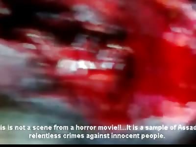 Man with Giant Hole in Throat still Allah Akbar