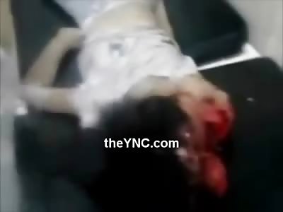 Very Sad Video of a Little Kids Head Cut in Half