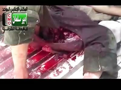 Poor Guys Groin Ripped to Shreds ... Damn, Might not be anything Worse