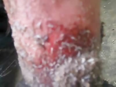 And THIS is Why you should Wash you Socks.....