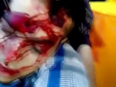 Boy Pulled out of Cab has his Head Split Open from Rifle Round