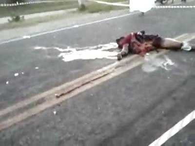 Motorcyclist thrown from Bike lost his Legs 