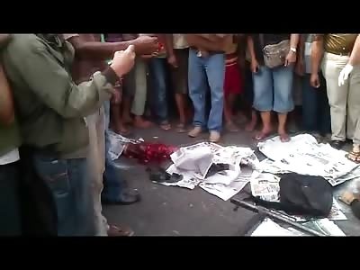 Nice Legs..Man has Both Legs Ripped Off