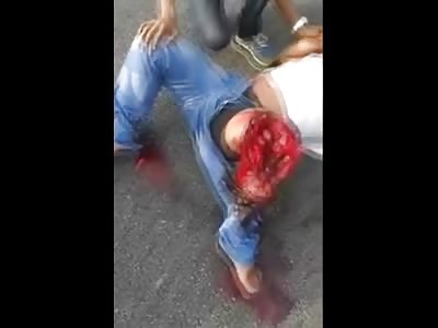 Man with a Nasty Split Knee Aye Yey Yey