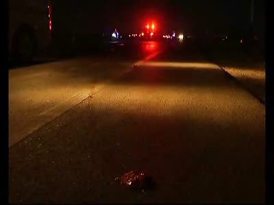 Man with Vacated Skull is Poked around by the Thai Medical Crew