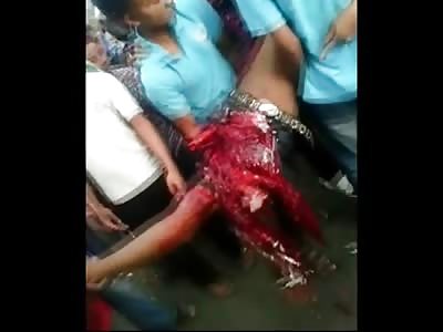 New Gruesome Video of the 2 Boys Blown Up by Fire is Disgusting