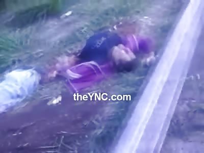 Man who hit a Guard Rail has his Entire Digestive System on the Street