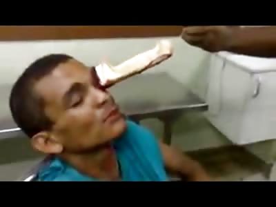 Man Stabbed with HUGE Knife Through his Eyeball is in Severe Pain Moaning 