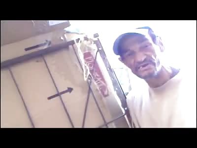 Insuranceless Homeless Guy Shows off His Deformed Arm That Healed after a Break