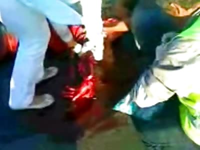 Tourniquet applied in the Street to Save a Man from Bleeding to Death