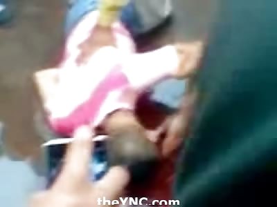 Man Shot in the Head Still Alive Bleeding out a Pool of Blood