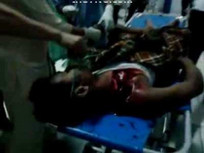 Shoulder and Chest Ripped to Shreds....Fighting for his Life