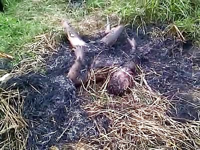 Man Burned in Half is still Somehow Breathing..(Better Quality Version)