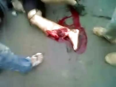 You want to Hear what Pain Sounds Like?