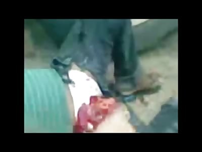 Man with Bad Bad Cut right next to his Groin in a World of hurt