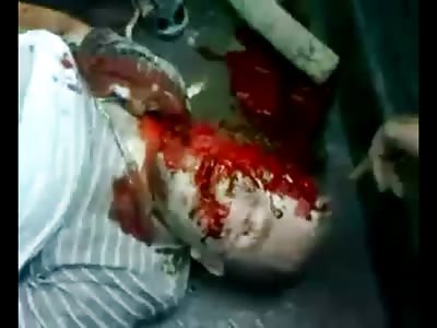 Man with Half a Face still trying to Breathe 