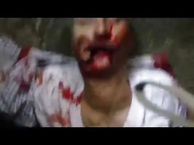 One Shot in the Mouth and One has his Eyes Gouged out