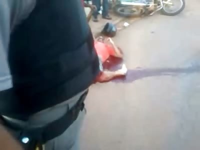 Dudes Leg Snapped Back in Total Agony