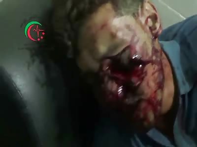 What the FUCK is Hanging out of this Guys Eye?