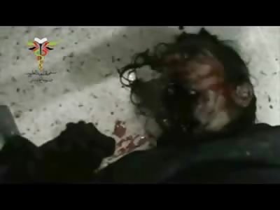 Man Trying to Breath and Talk with Mouth Shot Off