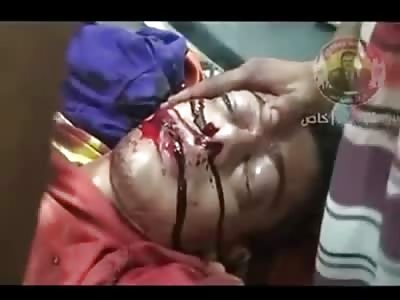 Man Slowly Dies, Gurgles and Vomits up Blood while Fighting to Stay Alive