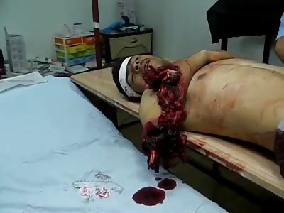 Don't Worry Dude....You'll be Playing Tennis Again in No time