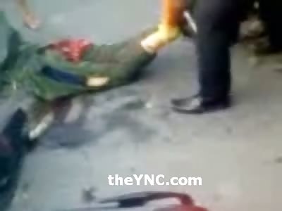 Scooter Man Head Dangles as he is Moved in the Street 