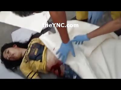 Young Dead Girl in Yellow Shirt on the Road after Being Killed in Accident 